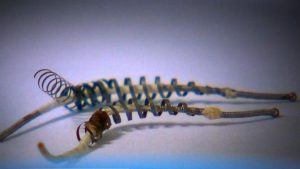 150922 gma ninan3 0803 16x9 992 300x169 - Essure Permanent Contraceptive Device