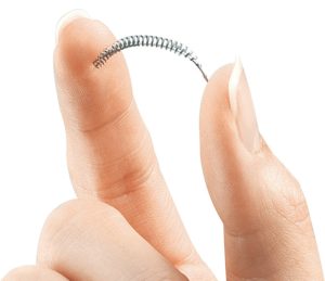 Essure coil image 300x259 - Essure Permanent Contraceptive Device